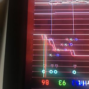 近距離の撃ち合いがなんか腑に落ちない事多くてネットワークグラフ出しながらやったらこんな感じでした　ダメージ25の武器で自分の4発目はクライアントヒットとしては認められてはいるけどサーバーヒットとして認められず、後からの敵の4発目は認められてやられたというグラフです。ping18で下り70あたり上り6あたりなんだけど回線悪いんでしょうか？それとも4みたいな弾抜けはこのゲームはよくあるんでしょうか？